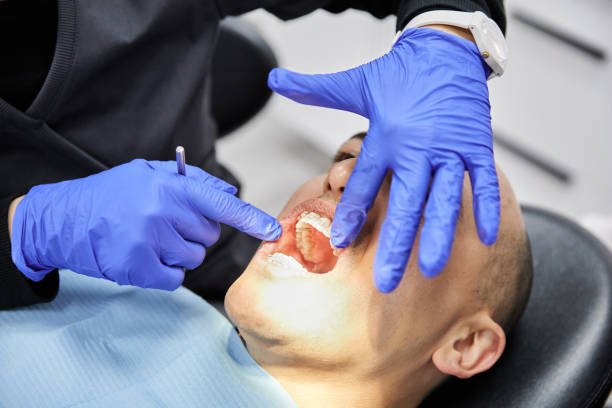 Best Emergency Wisdom Tooth Extraction in Vernon, TX